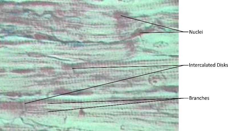 Cardiac Muscle micrograph